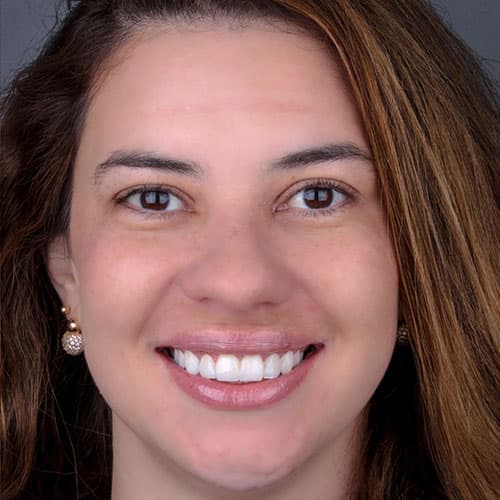 Depois do tratamento