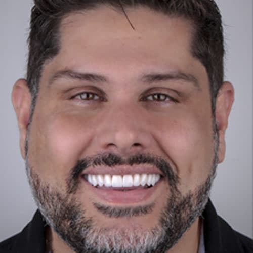 Depois do tratamento